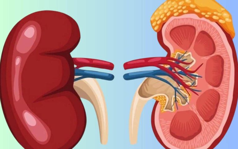 What Foods Helps To Repair Kidneys : Foods & Diet Plan