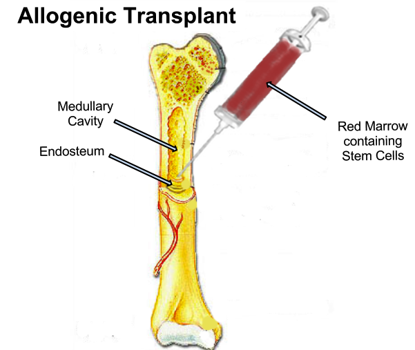 Bone Marrow